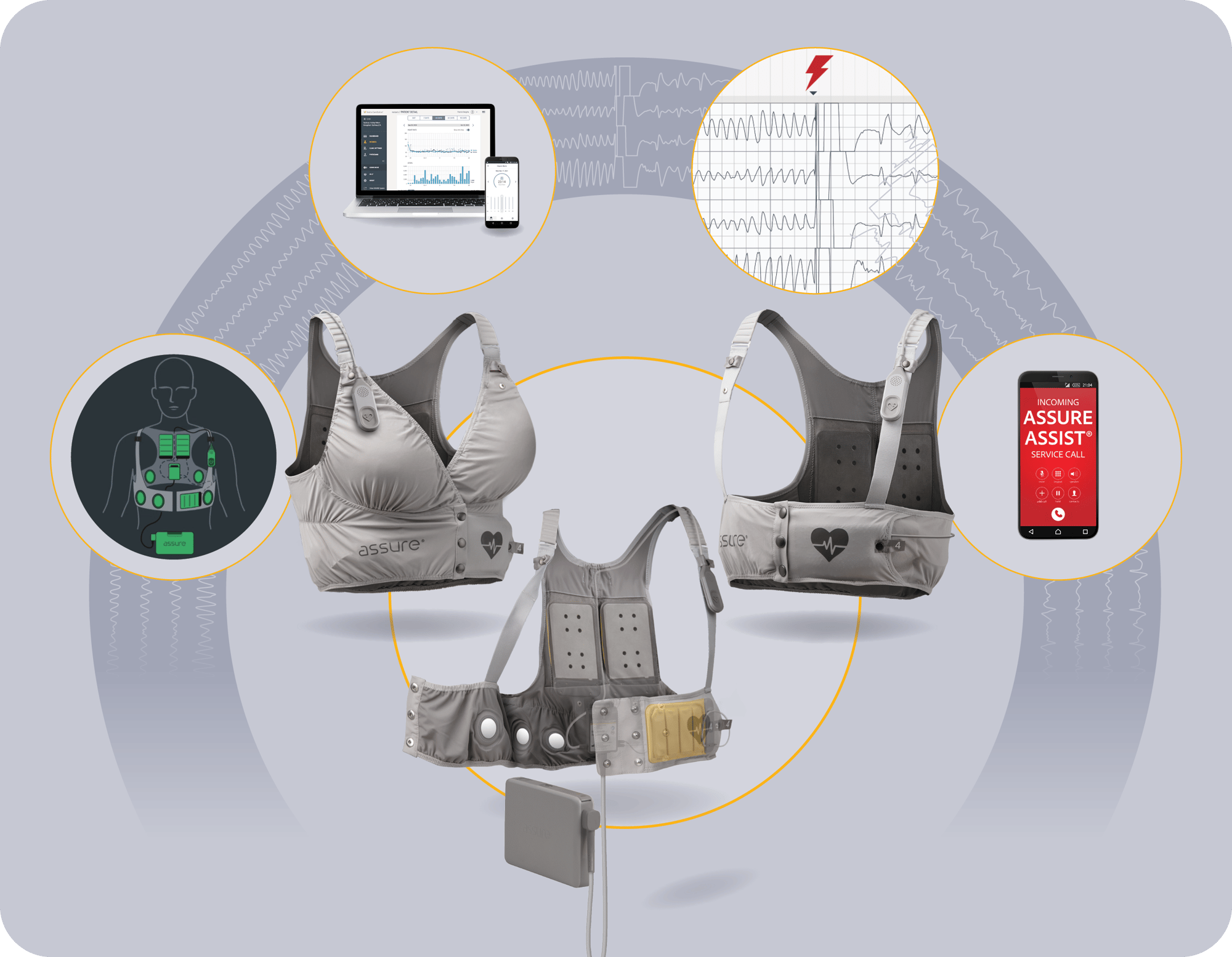 IMG_027B Graphic, Anatomy of a WCD composite image, 16x9 IMG_027B Graphic, Anatomy of a WCD composite image, 16x9