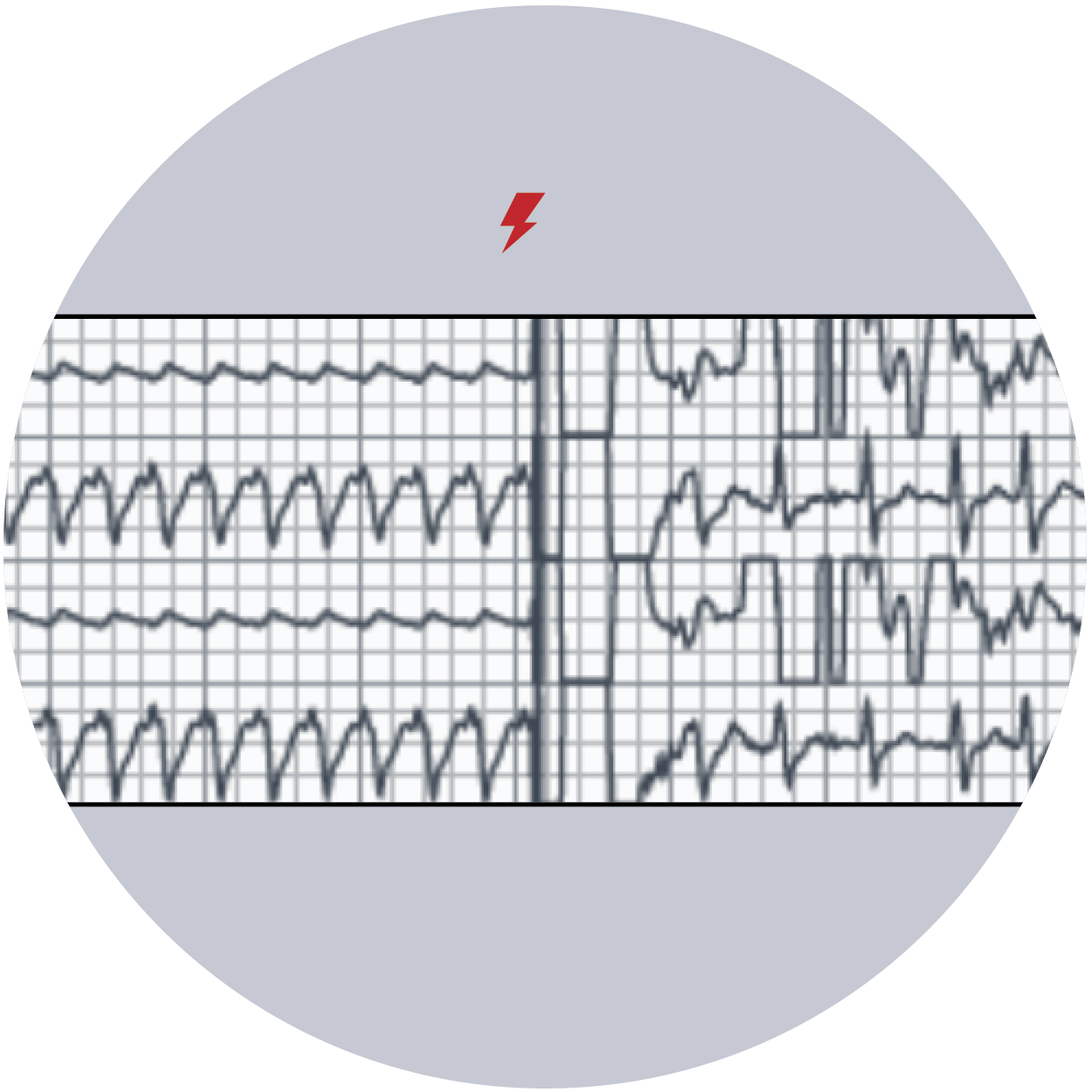 Rhythm-Strip Rhythm-Strip